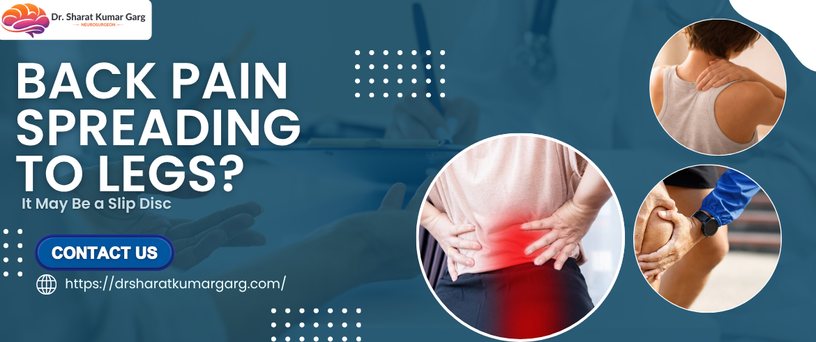 Why Your Startup Need Cash News Blog.